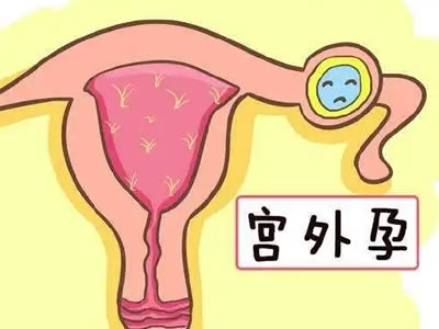 警惕！這些女性更易患宮外孕