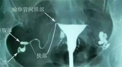 給高齡備孕女性的忠告：5個誤區(qū)，提前知道！